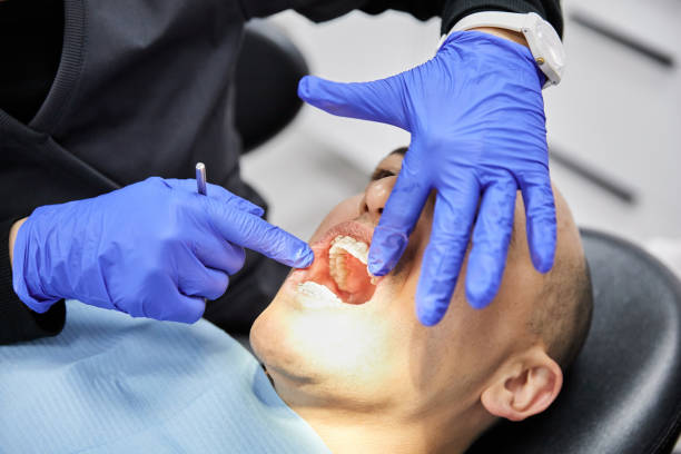 Best Emergency Treatment for Dental Infections or Abscesses in Highland Springs, VA