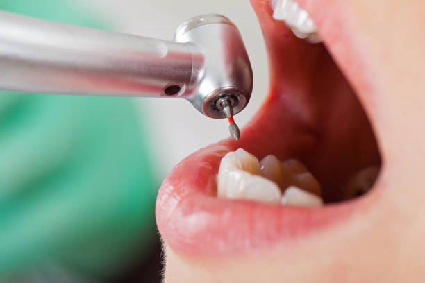 Best Emergency Dental Care for Broken or Chipped Teeth in Highland Springs, VA